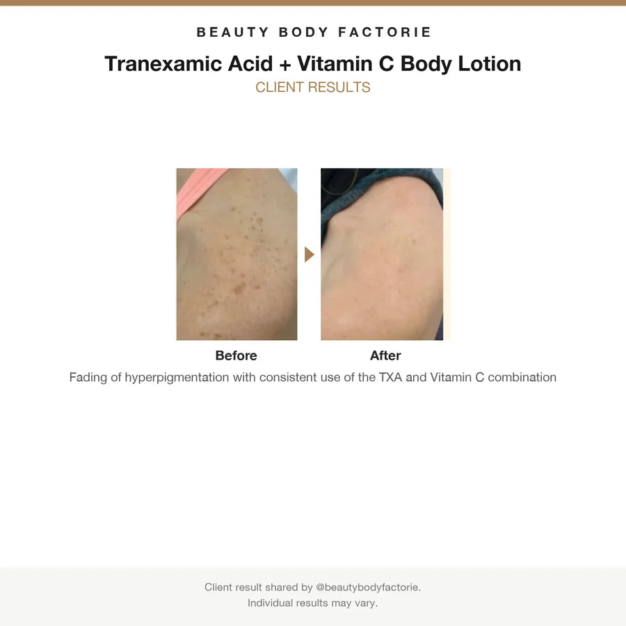 Beauty Body Factorie Tranexamic Acid and Vitamin C Body Lotion