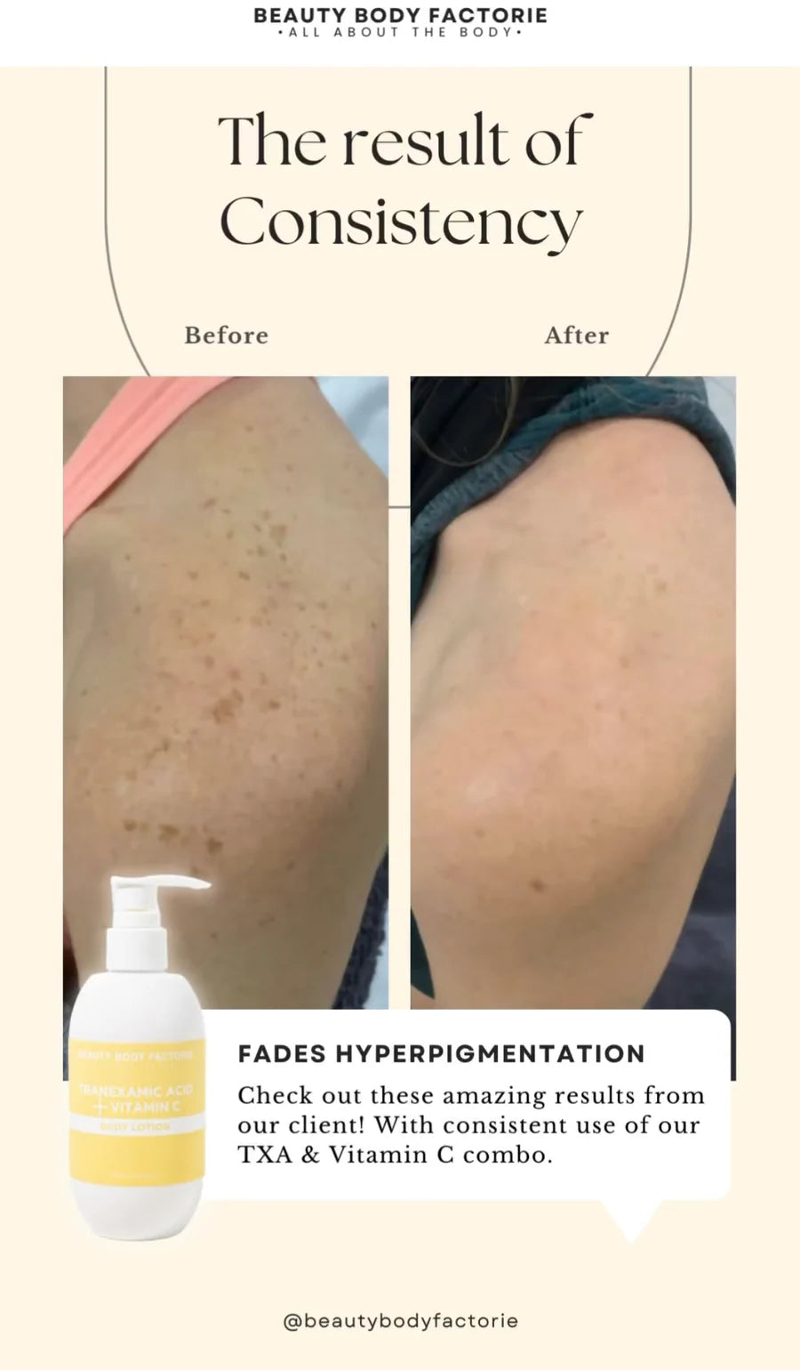 Beauty Body Factorie Tranexamic Acid and Vitamin C Body Lotion