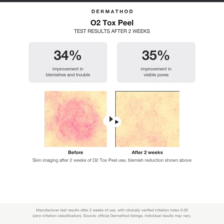 Dermathod O2 Tox Peel (Spicule Peel Serum) New Formula