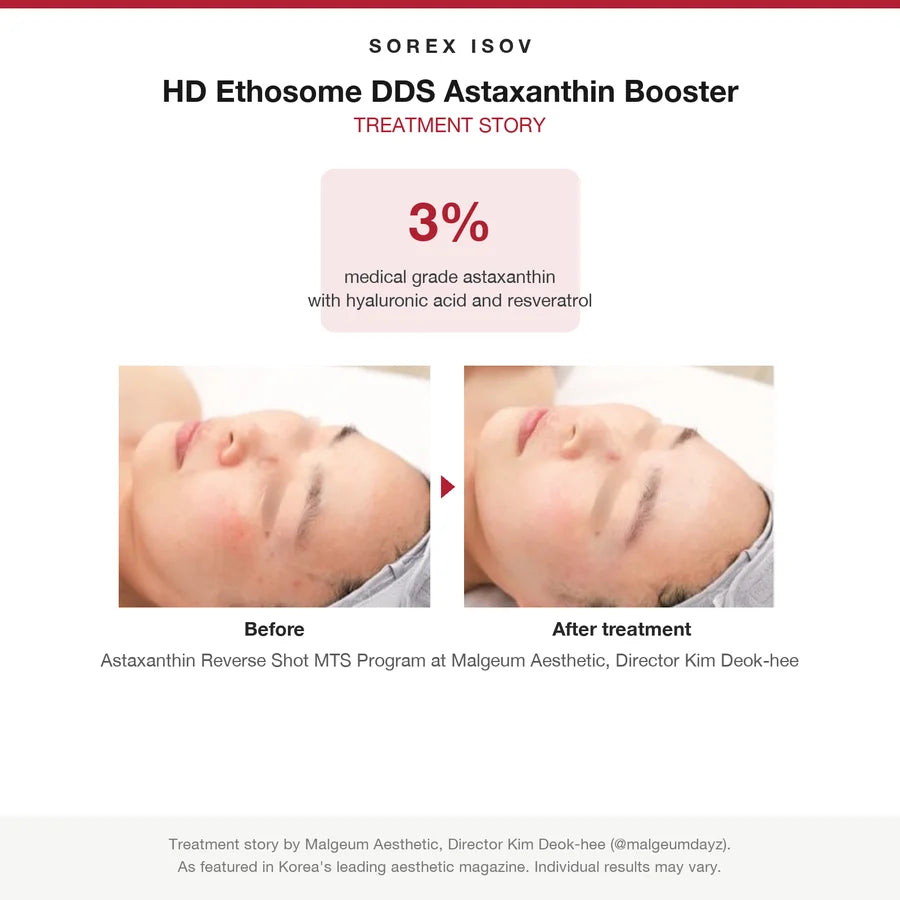ISOV HD Ethosome DDS Astaxanthin Booster